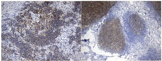 MME Antibody in Immunohistochemistry (Paraffin) (IHC (P))