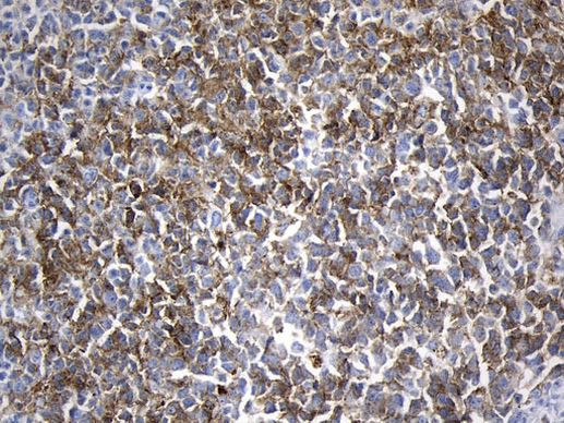 MME Antibody in Immunohistochemistry (Paraffin) (IHC (P))