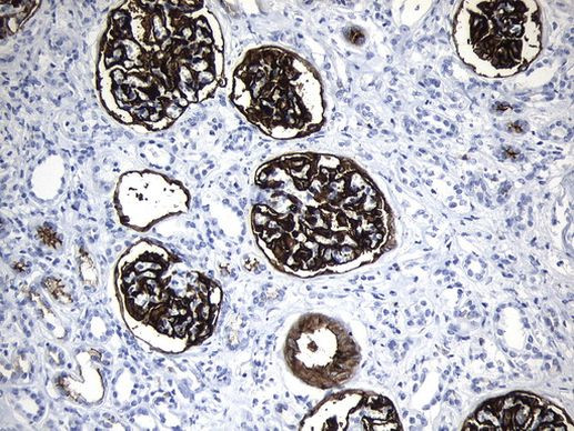 MME Antibody in Immunohistochemistry (Paraffin) (IHC (P))