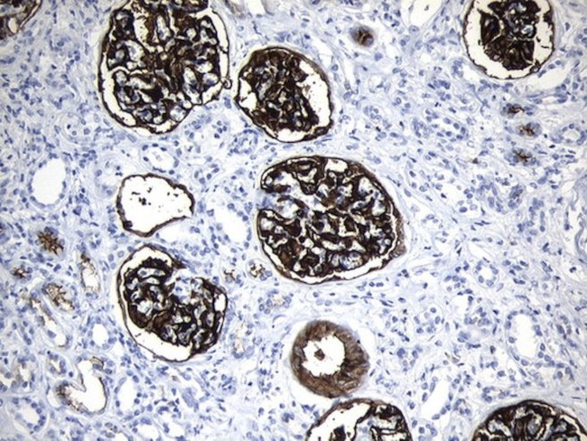 MME Antibody in Immunohistochemistry (Paraffin) (IHC (P))