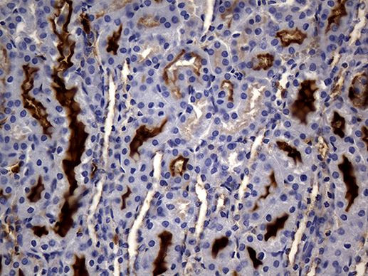 MME Antibody in Immunohistochemistry (Paraffin) (IHC (P))