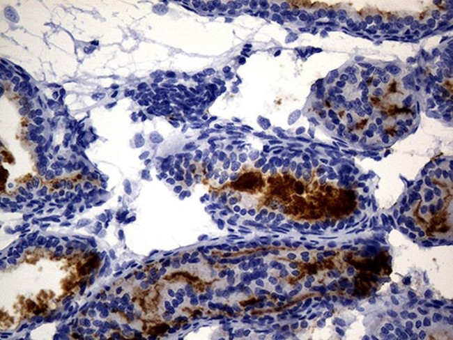 MME Antibody in Immunohistochemistry (Paraffin) (IHC (P))