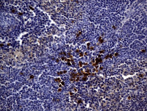 MME Antibody in Immunohistochemistry (Paraffin) (IHC (P))