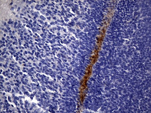 MME Antibody in Immunohistochemistry (Paraffin) (IHC (P))