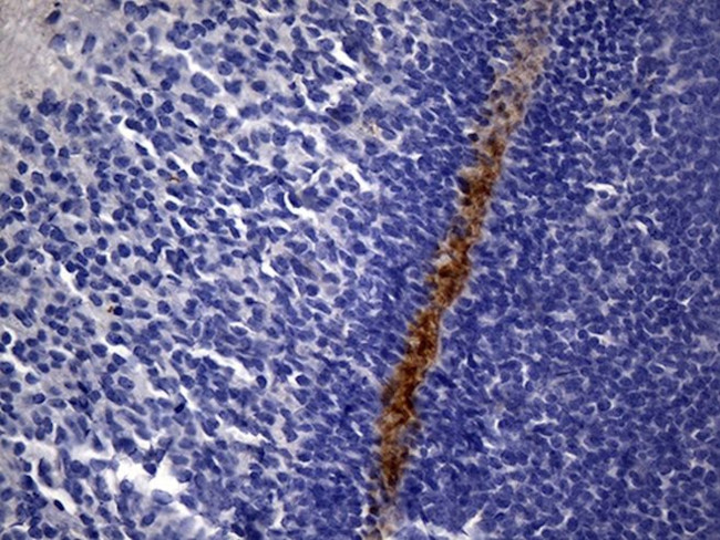 MME Antibody in Immunohistochemistry (Paraffin) (IHC (P))