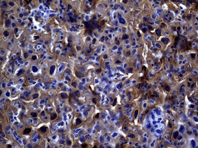 MME Antibody in Immunohistochemistry (Paraffin) (IHC (P))