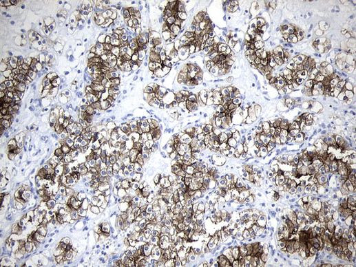 MME Antibody in Immunohistochemistry (Paraffin) (IHC (P))