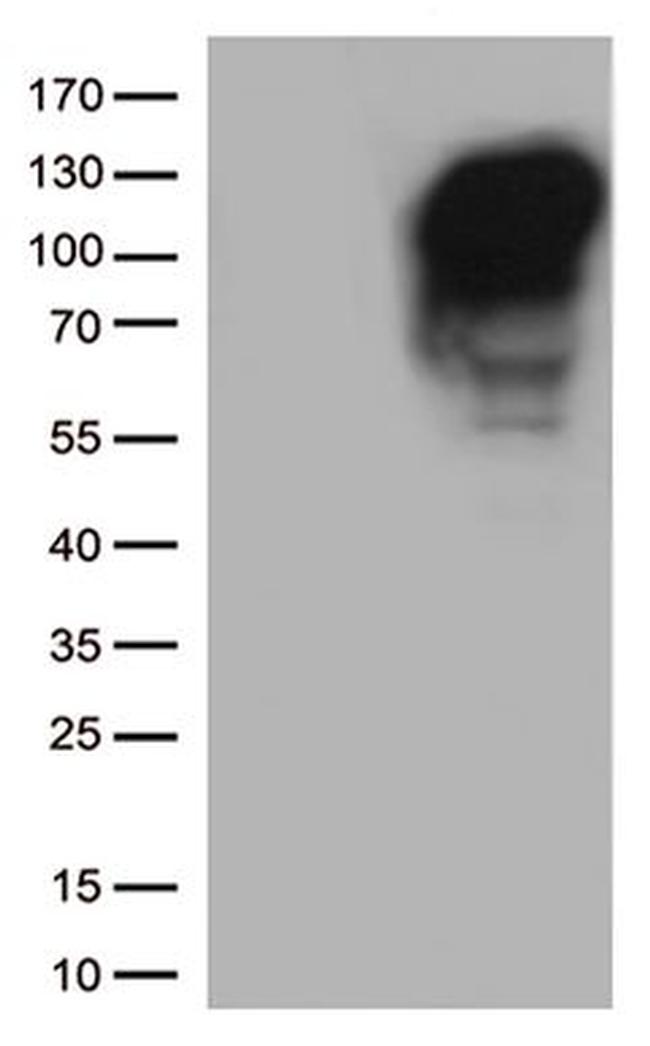 MME Antibody in Western Blot (WB)