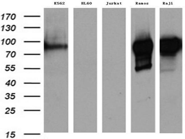 MME Antibody in Western Blot (WB)