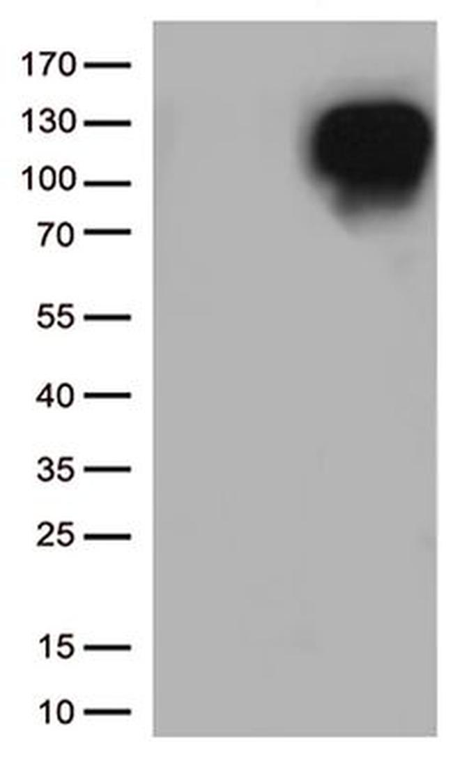 MME Antibody in Western Blot (WB)