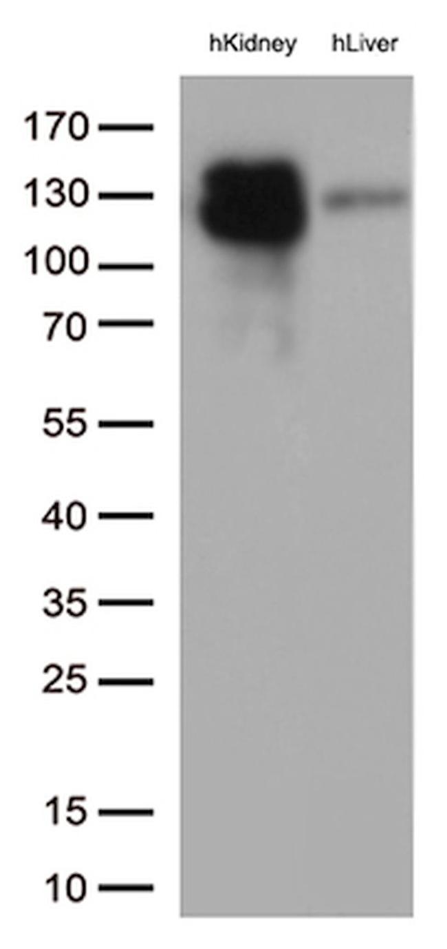 MME Antibody in Western Blot (WB)