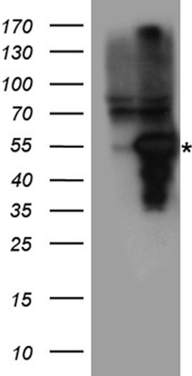 MMP11 Antibody in Western Blot (WB)