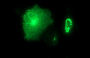 MMP13 Antibody in Immunocytochemistry (ICC/IF)