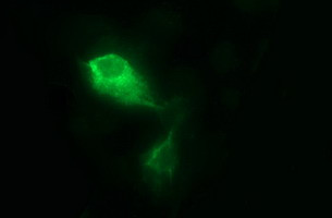 MMP13 Antibody in Immunocytochemistry (ICC/IF)