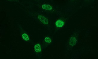 MMP13 Antibody in Immunocytochemistry (ICC/IF)