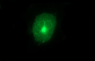 MMP13 Antibody in Immunocytochemistry (ICC/IF)