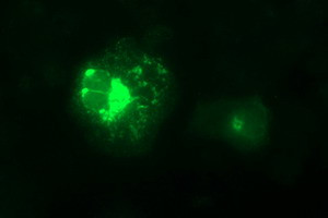 MMP13 Antibody in Immunocytochemistry (ICC/IF)