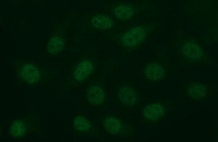 MMP13 Antibody in Immunocytochemistry (ICC/IF)