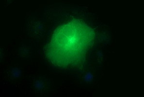 MMP13 Antibody in Immunocytochemistry (ICC/IF)