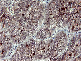 MMP13 Antibody in Immunohistochemistry (Paraffin) (IHC (P))