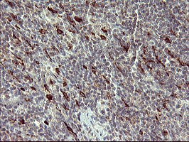 MMP13 Antibody in Immunohistochemistry (Paraffin) (IHC (P))