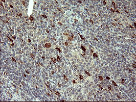 MMP13 Antibody in Immunohistochemistry (Paraffin) (IHC (P))