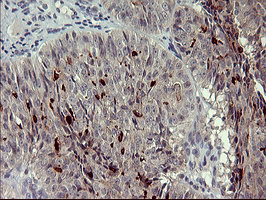 MMP13 Antibody in Immunohistochemistry (Paraffin) (IHC (P))