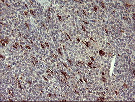 MMP13 Antibody in Immunohistochemistry (Paraffin) (IHC (P))