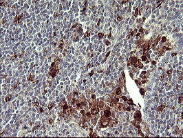 MMP13 Antibody in Immunohistochemistry (Paraffin) (IHC (P))