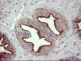 MMP13 Antibody in Immunohistochemistry (Paraffin) (IHC (P))