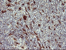 MMP13 Antibody in Immunohistochemistry (Paraffin) (IHC (P))