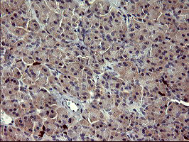 MMP13 Antibody in Immunohistochemistry (Paraffin) (IHC (P))