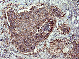 MMP13 Antibody in Immunohistochemistry (Paraffin) (IHC (P))