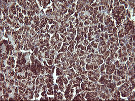 MMP13 Antibody in Immunohistochemistry (Paraffin) (IHC (P))