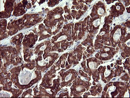 MMP13 Antibody in Immunohistochemistry (Paraffin) (IHC (P))