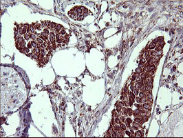 MMP13 Antibody in Immunohistochemistry (Paraffin) (IHC (P))