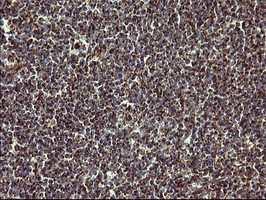 MMP13 Antibody in Immunohistochemistry (Paraffin) (IHC (P))