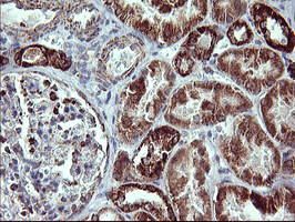 MMP13 Antibody in Immunohistochemistry (Paraffin) (IHC (P))