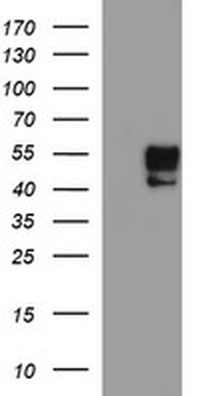 MMP13 Antibody in Western Blot (WB)