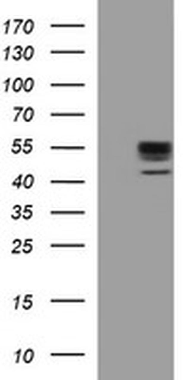 MMP13 Antibody in Western Blot (WB)