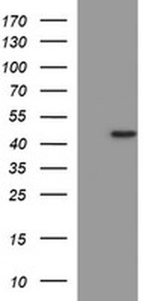 MMP13 Antibody in Western Blot (WB)