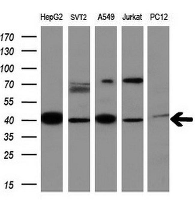 MMP13 Antibody in Western Blot (WB)