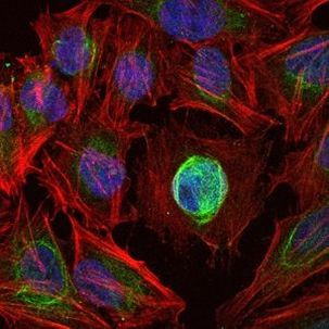 MMP1 Antibody in Immunocytochemistry (ICC/IF)