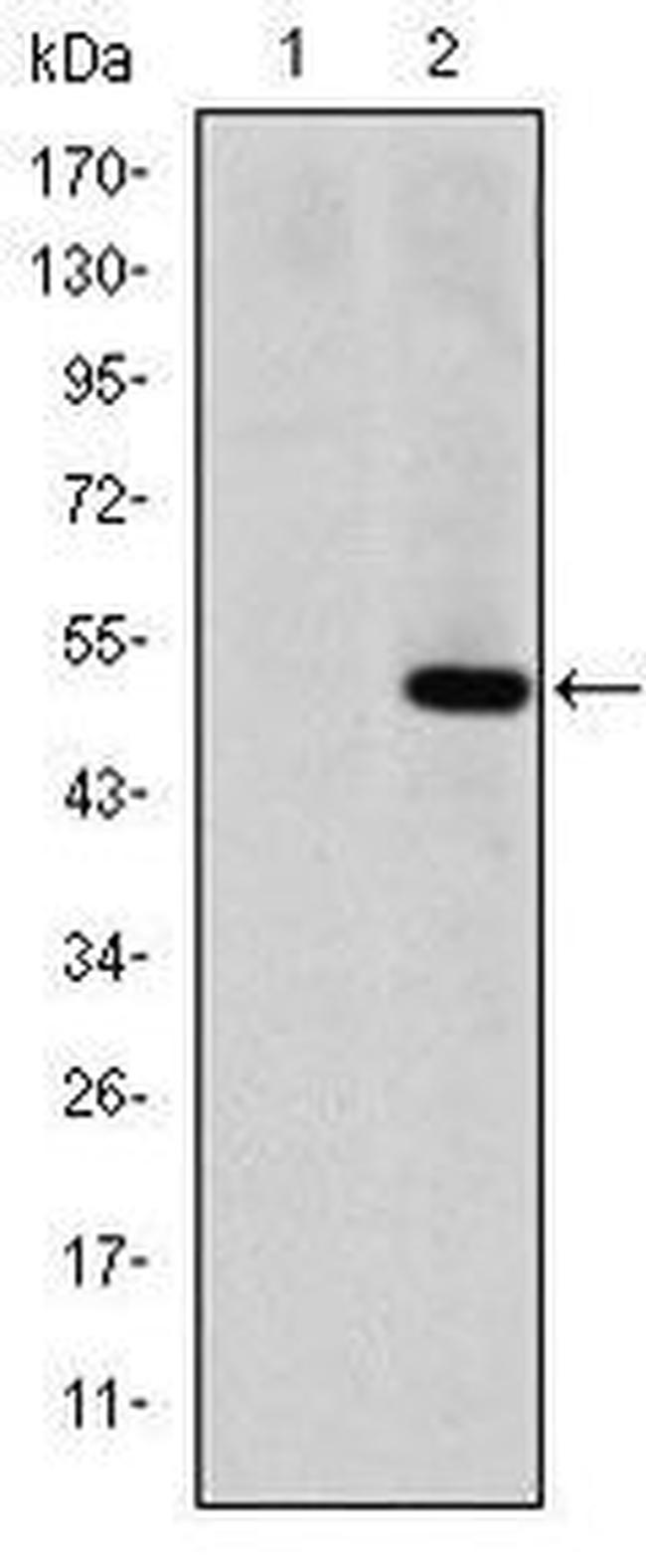 MMP1 Antibody in Western Blot (WB)