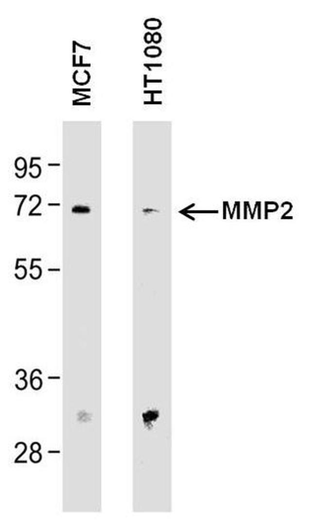 MMP2 Antibody in Western Blot (WB)