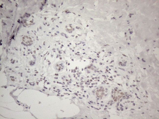 MMP2 Antibody in Immunohistochemistry (Paraffin) (IHC (P))