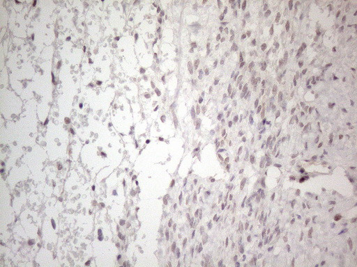 MMP2 Antibody in Immunohistochemistry (Paraffin) (IHC (P))