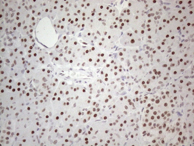 MMP2 Antibody in Immunohistochemistry (Paraffin) (IHC (P))