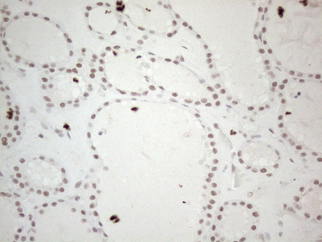 MMP2 Antibody in Immunohistochemistry (Paraffin) (IHC (P))