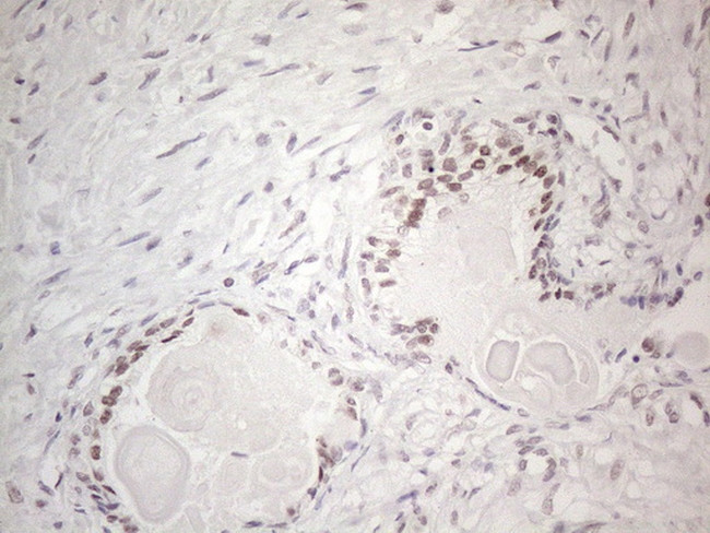 MMP2 Antibody in Immunohistochemistry (Paraffin) (IHC (P))